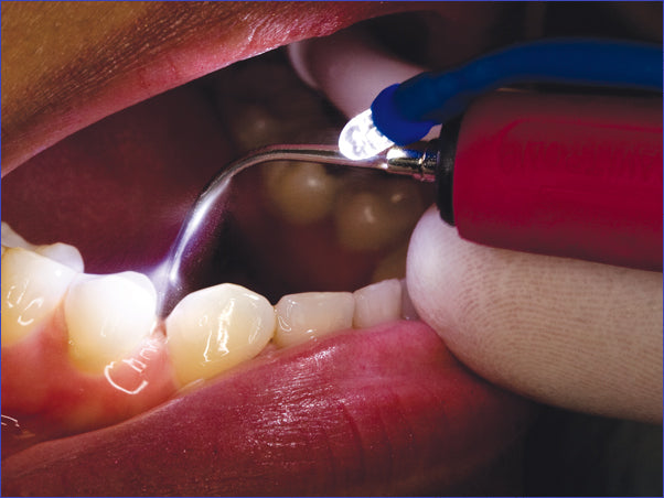 <strong>Siriona Dentsply Cavitron® Steri-Mate Light</strong><br> LED-Beleuchtungssystem