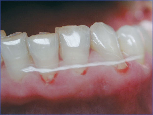 <strong>Hager & Werken Miradont®-Gel</strong><br>Schutz & Pflege-Gel - Wundversorgung