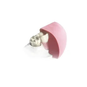 dentona 1:1 gum Knetsilikon Shore A 85