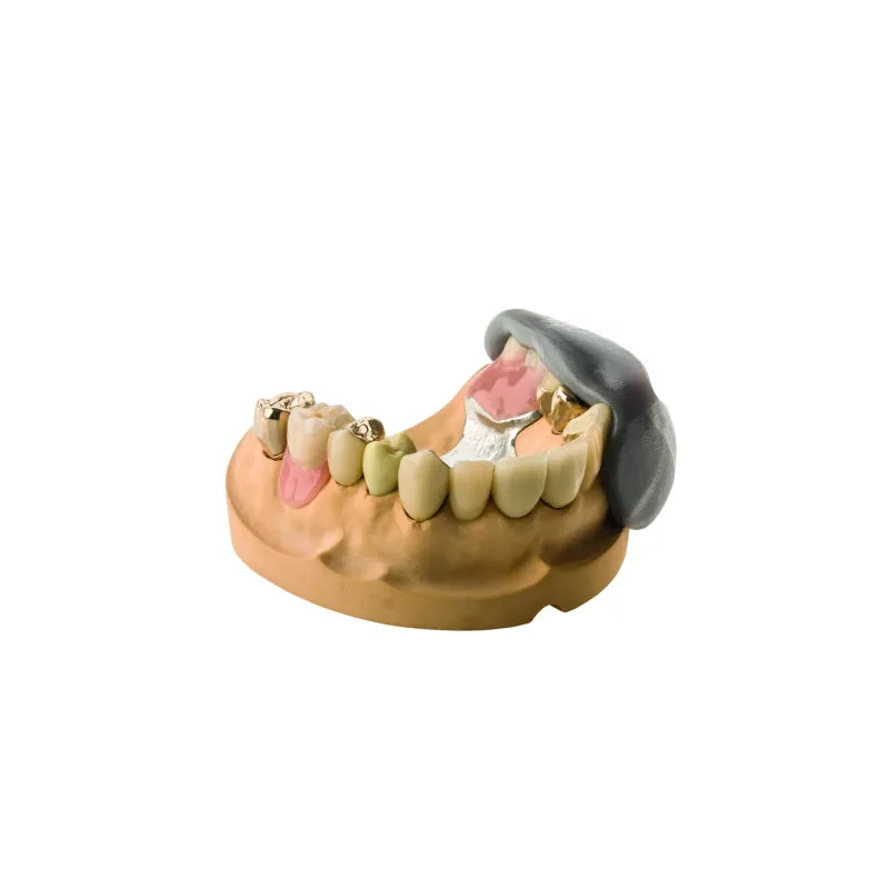 dentona 1:1 softgum Knetsilikon Shore A 85