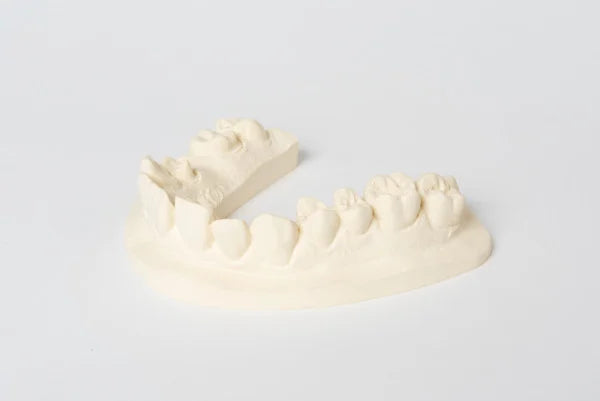 dentona No.1 Spezial-Stumpfgips für präzise Dentalmodelle