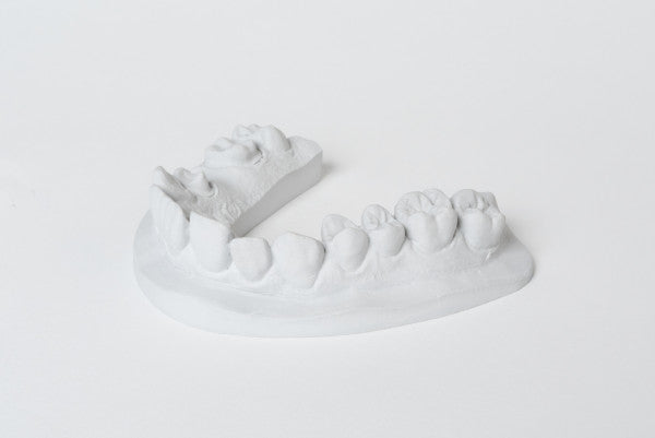 dentona esthetic-rock 285 Spezial-Stumpfgips für Dentalmodelle