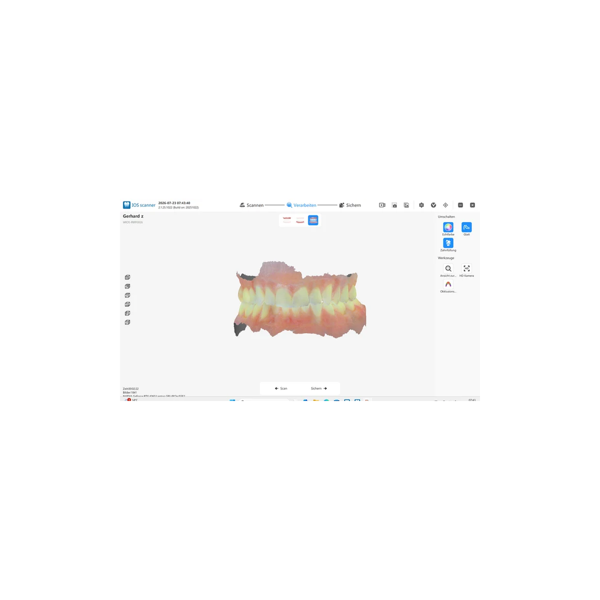 Schick Dental DX Mobile Intraoralscanner mit kabelloser Verbindung