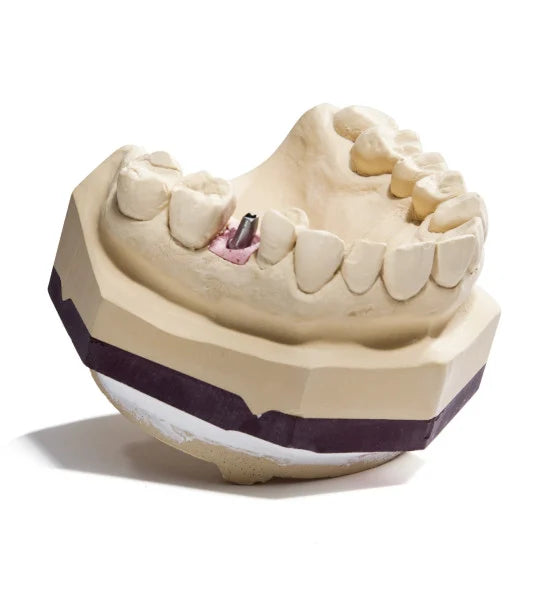 dentona ZERO stone® Spezial-Superhartgips Typ 4 mit 0,00 % Expansion