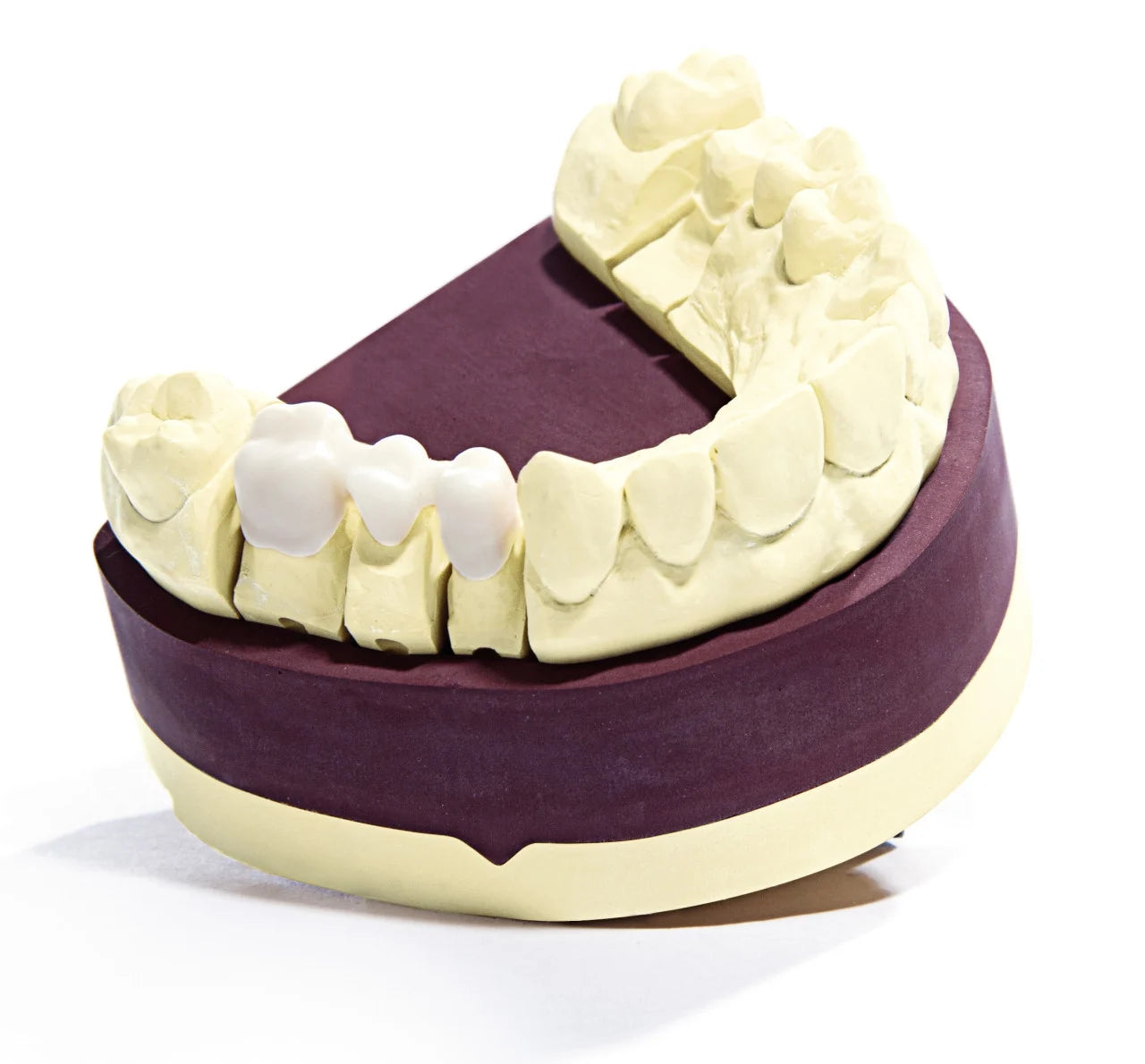 dentona esthetic-base evolution Spezial-Stumpfgips für brillante Zahnkränze