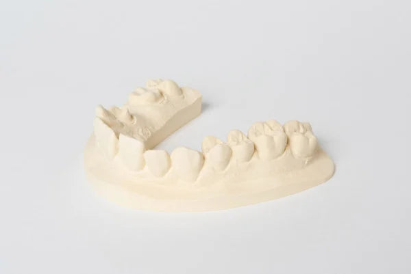 dentona uni-base 300 Spezial-Stumpfgips für Dentalmodelle