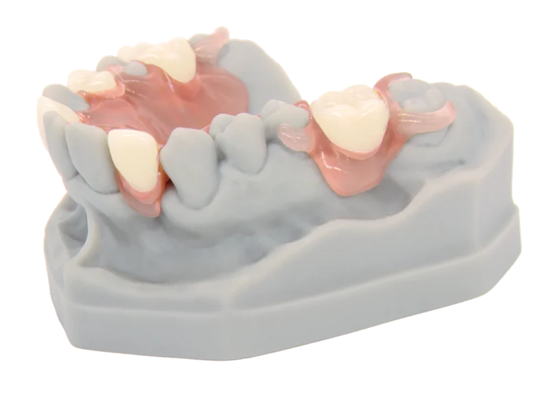 dentona vivapink thermoelastischer Prothesenkunststoff für flexible Interimsversorgungen