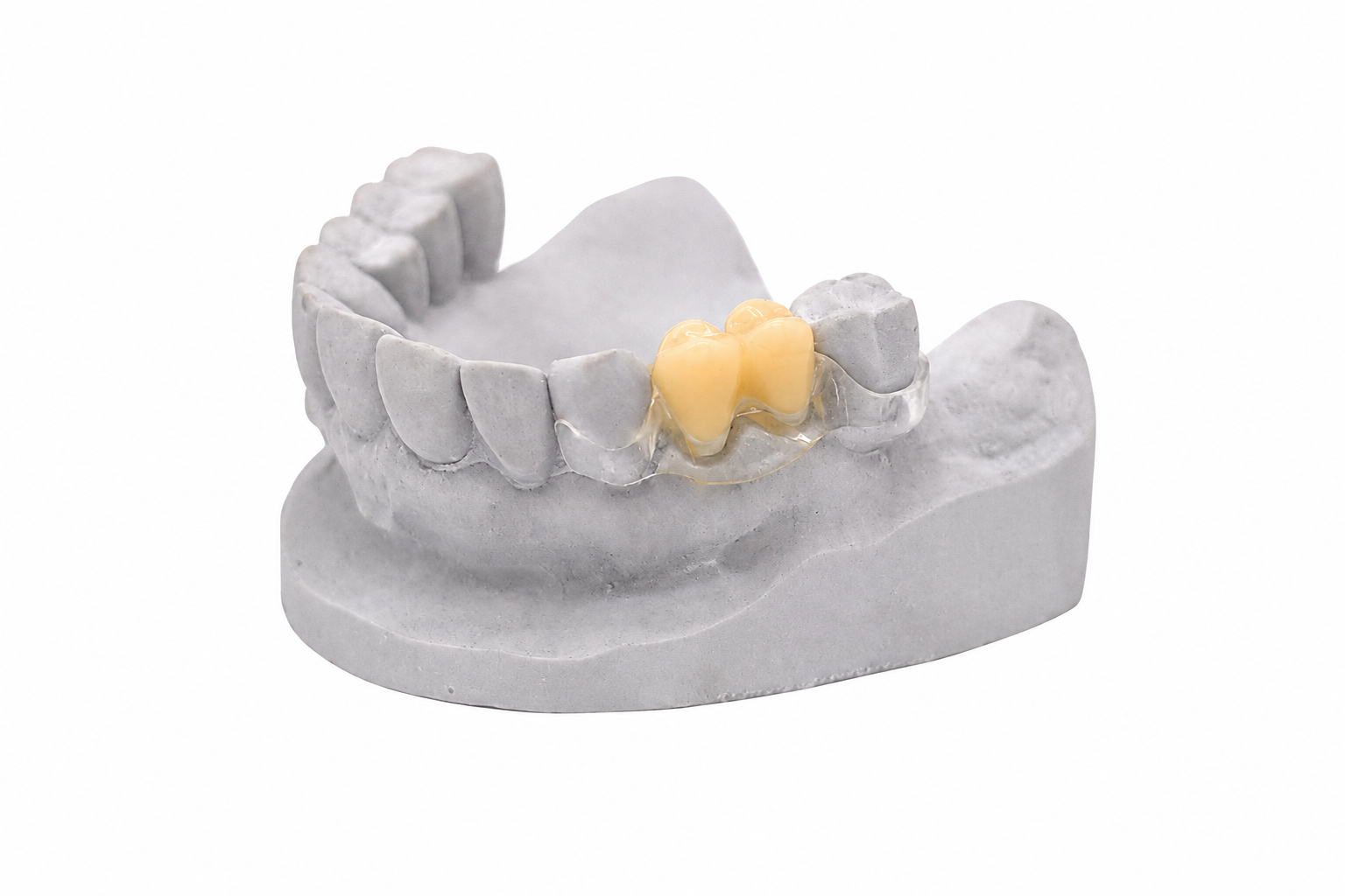 dentona vivatemp Pulver 150 g für flexible Aufbissschienen