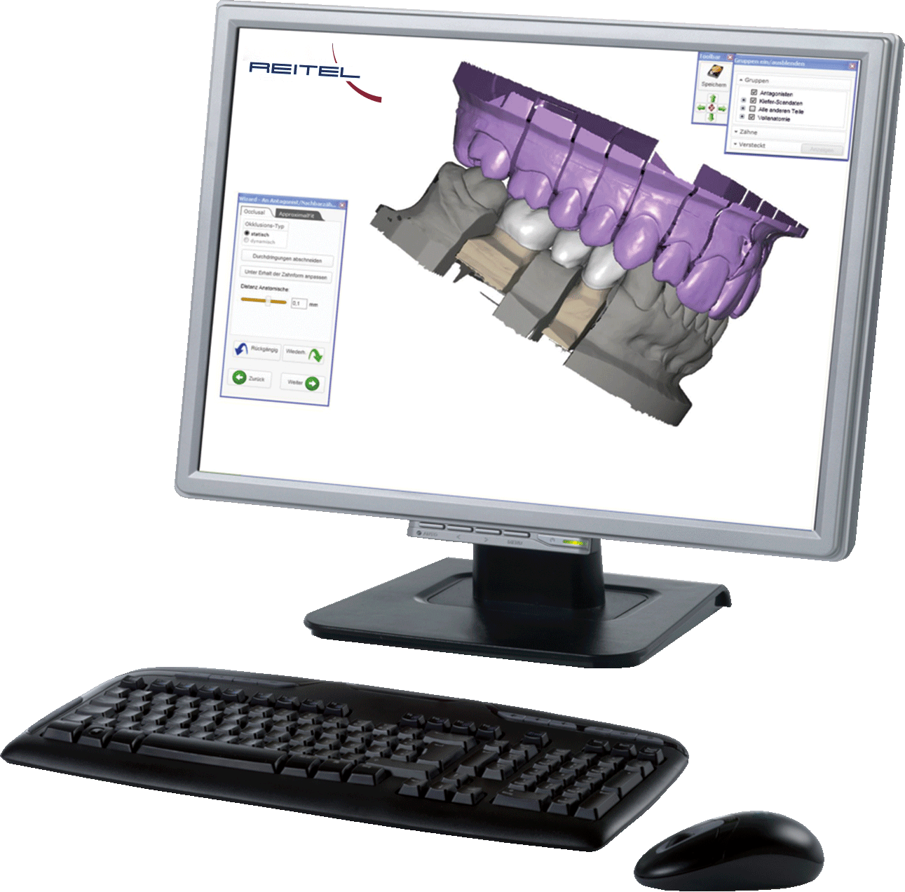 exocad Design Software Implant Ultimate Package für digitale Zahntechnik und Implantatprothetik