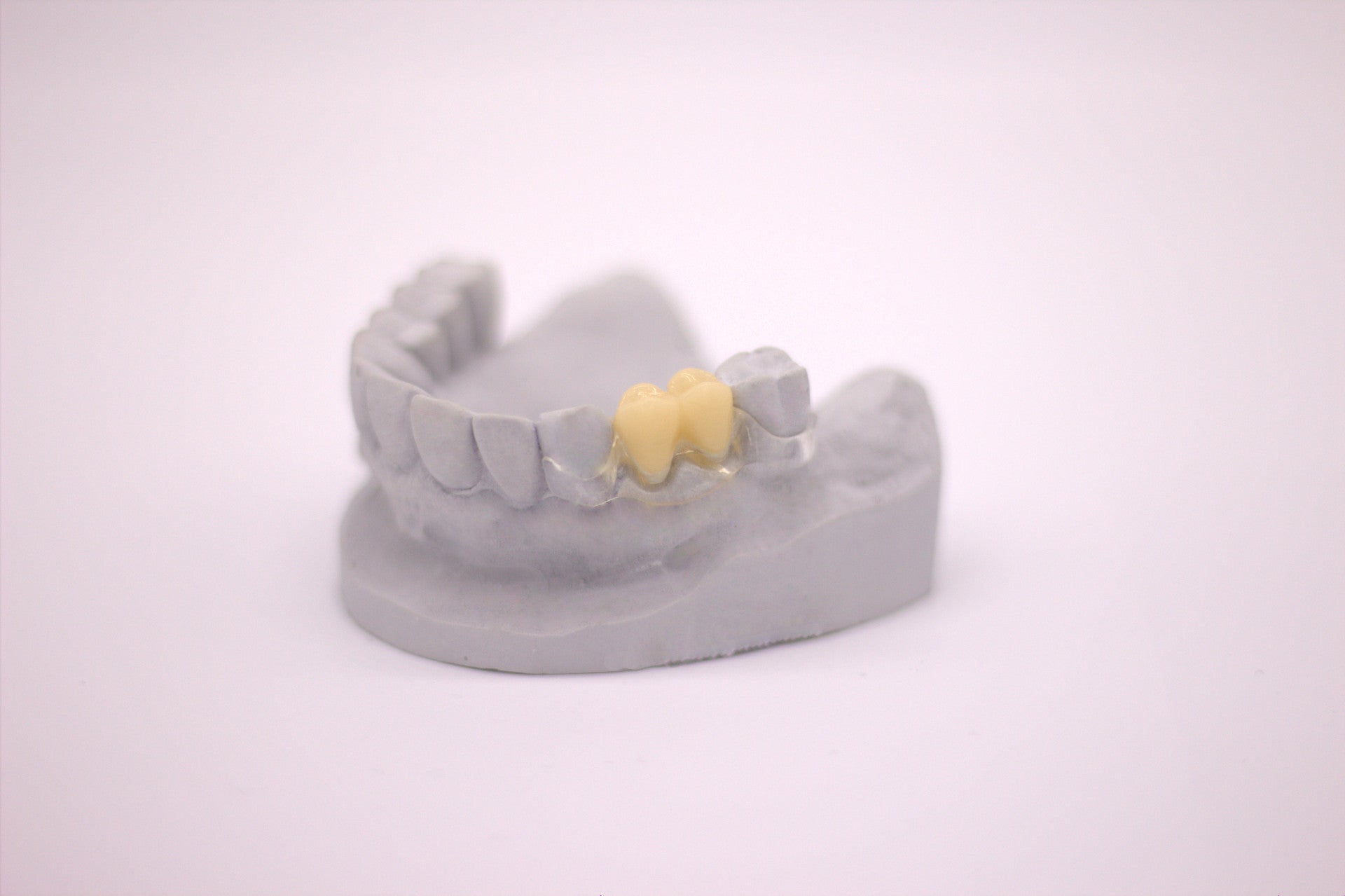 dentona vivatemp® Liquid – für Schienenkunststoff
